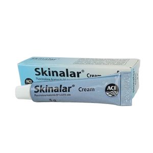 Skinalar