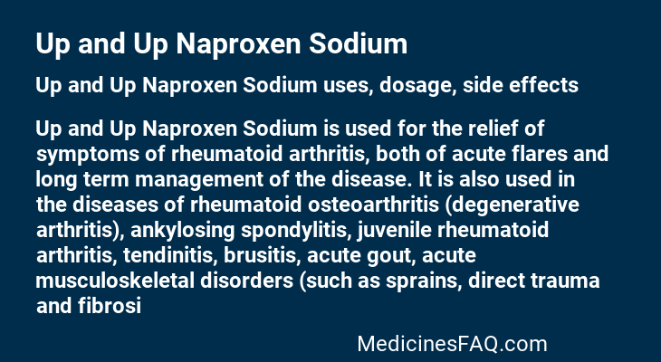 Up and Up Naproxen Sodium